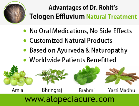 Advantages of Dr. Rohit's natual treatment for telogen effluvium- Based on Ayurveda & Naturopathy - Customized Natural Treatments - No oral pills, No chemicals - Worldwide Patients Benifited