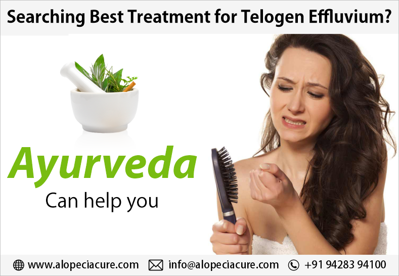 telogen effluvium treatment