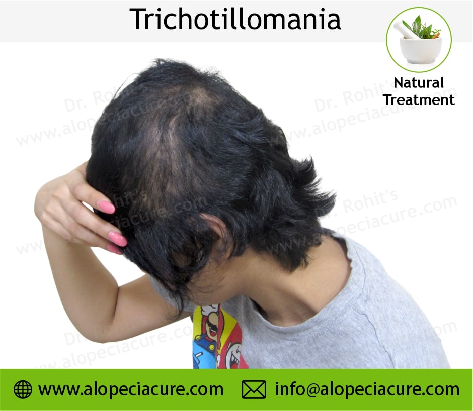 trichotillomania