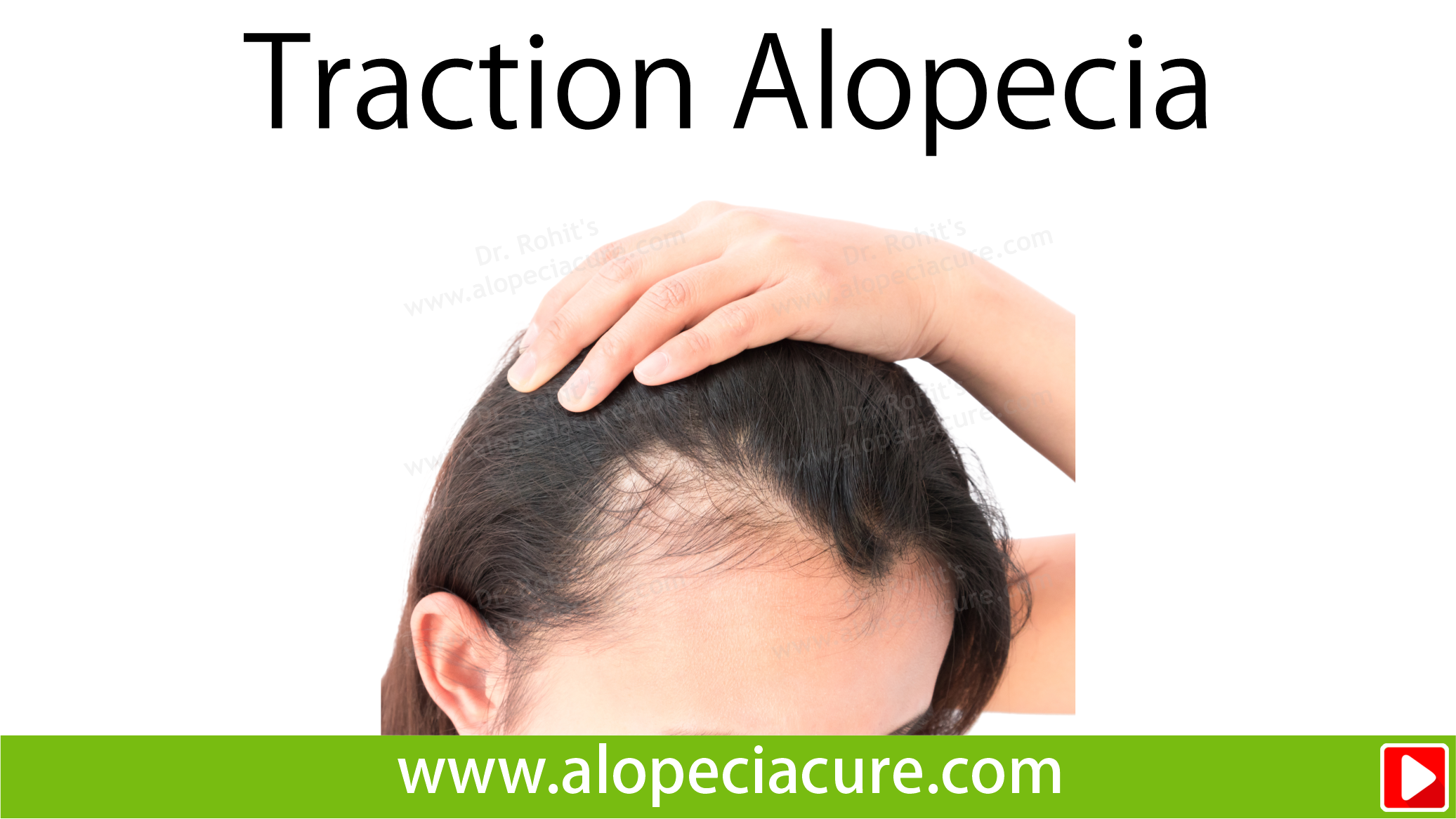 tractional alopecia