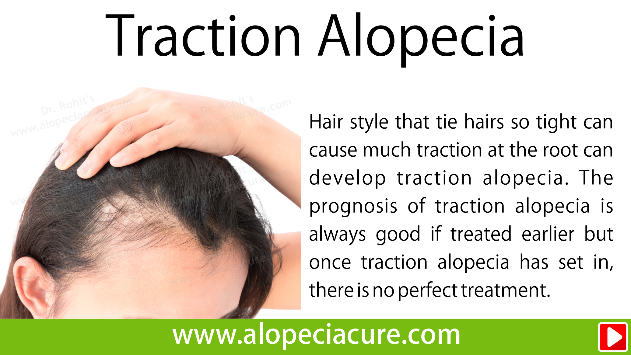 tractional alopecia treatment