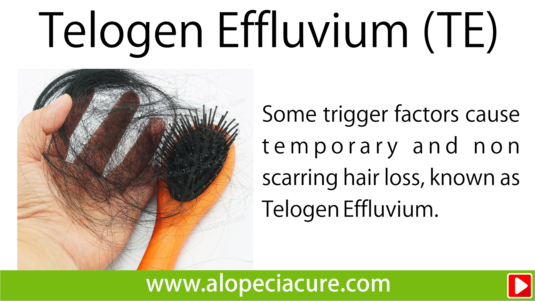 telogen effluvium